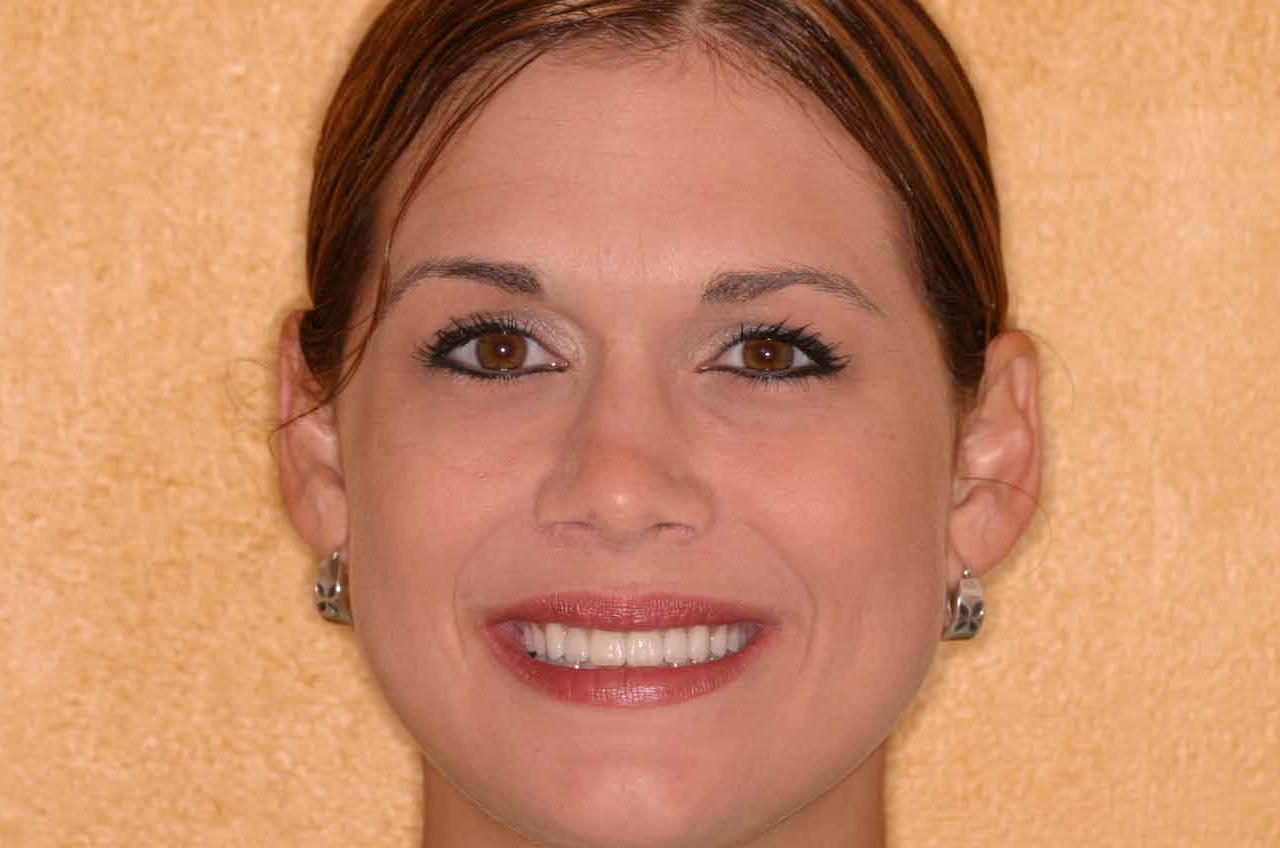 Cosmetic Dentist Fort Myers Cape Coral Naples FL